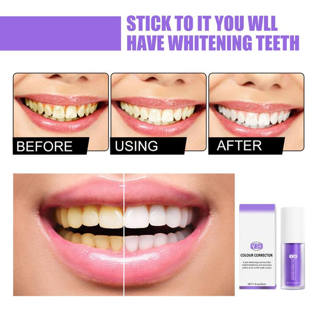 Beyond Bright Whitening Toothpaste